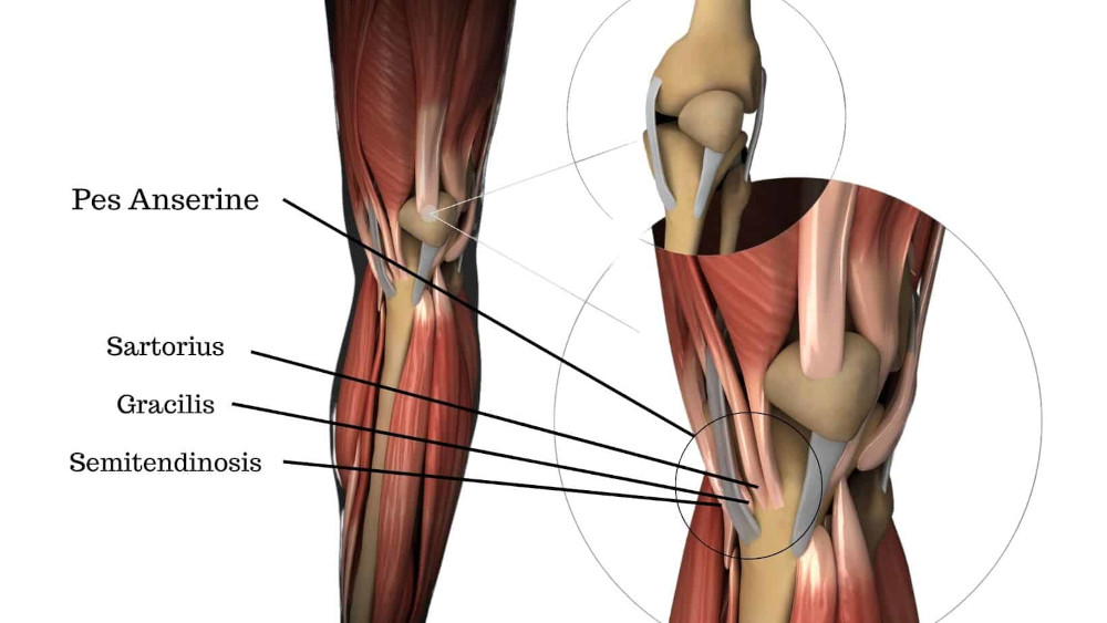 Image showing treatment techniques for Pes Anserine bursitis, focusing on rehabilitation methods for runners.