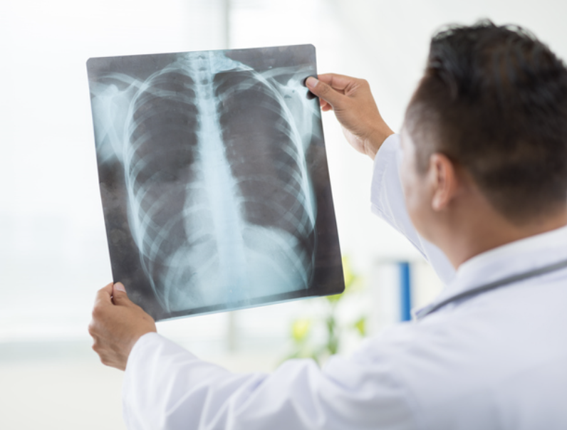 Physiotherapist examining chest X-ray to explain when medical imaging is necessary Physiotherapist examining chest X-ray to explain when medical imaging is necessary