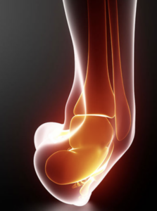 Physiotherapist assessing a patient's swollen ankle during an in-clinic evaluation